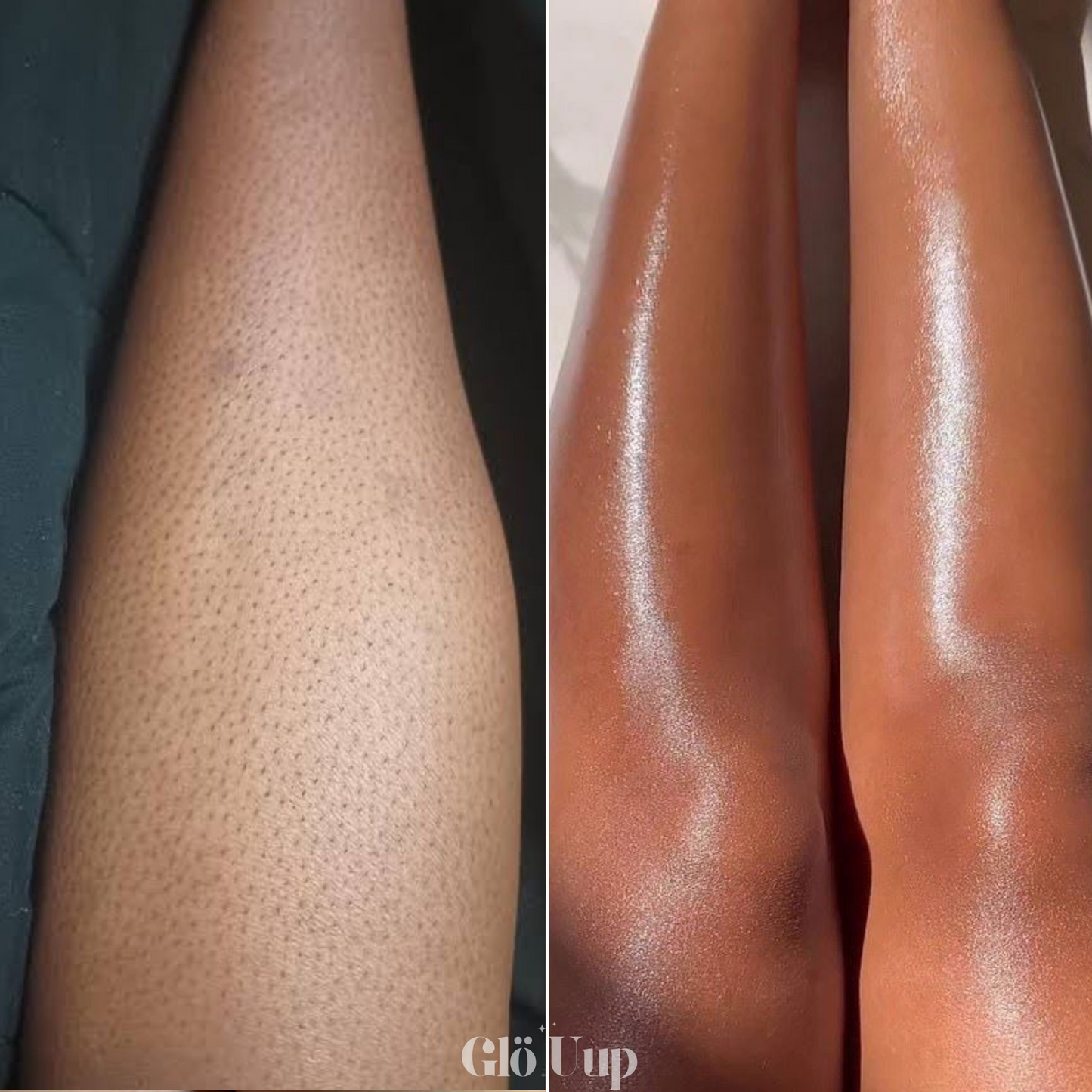 GlöUup Razor- Flawless skin in seconds, lasts FOREVER